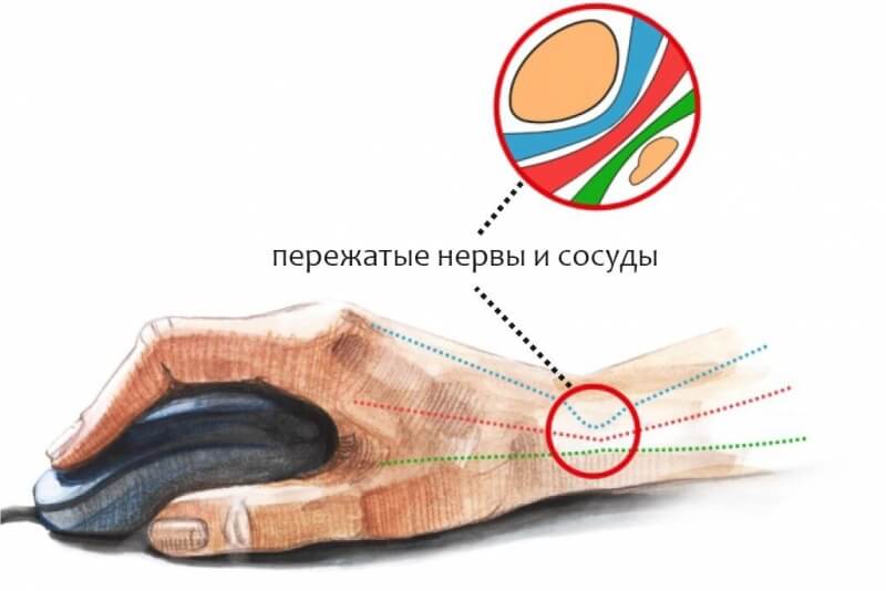 Что с кракеном сайт